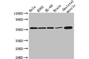 Western Blot Positive WB detected in: Hela whole cell lysate, K562 whole cell lysate, HL60 whole cell lysate, Mouse brain tissue, Mouse skeletal muscle tissue All lanes: ZBTB43 antibody at 3 μg/mL Secondary Goat polyclonal to rabbit IgG at 1/50000 dilution Predicted band size: 53 kDa Observed band size: 53 kDa (ZBTB43 抗体  (AA 165-467))
