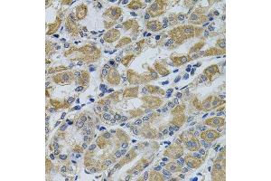 Immunohistochemistry (Paraffin-embedded Sections) (IHC (p)) image for anti-PTK7 Protein tyrosine Kinase 7 (PTK7) (AA 811-1070) antibody (ABIN6146429)