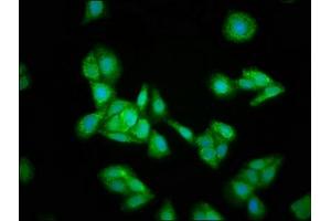 Immunofluorescence staining of HepG2 cells with ABIN7156004 at 1:133, counter-stained with DAPI.