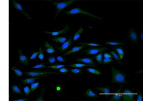 Immunofluorescence of purified MaxPab antibody to IFNA17 on HeLa cell. (IFNA17 抗体  (AA 1-189))