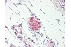 Anti-NOS1 / nNOS antibody IHC staining of human small intestine, submucosal plexus. (NOS1 抗体  (N-Term))