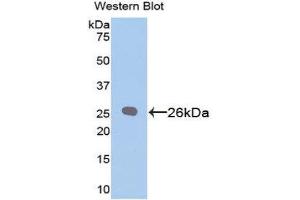 Western Blotting (WB) image for anti-B-Cell CLL/lymphoma 2 (BCL2) (AA 2-208) antibody (ABIN1858119) (Bcl-2 抗体  (AA 2-208))
