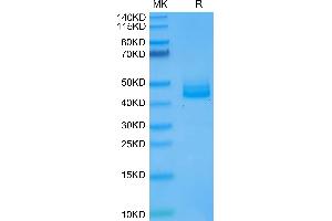 IL12B Protein (AA 23-328) (His tag)