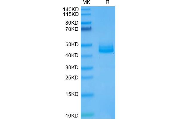 IL12B Protein (AA 23-328) (His tag)