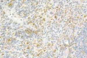 Immunohistochemistry analysis of paraffin-embedded rat spleen using,Resistin (ABIN7075402) at dilution of 1: 800 (Resistin 抗体)