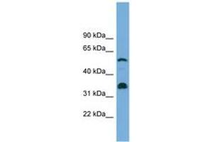 Image no. 1 for anti-Cytochrome P450, Family 26, Subfamily B, Polypeptide 1 (CYP26B1) (C-Term) antibody (ABIN6744176) (CYP26B1 抗体  (C-Term))