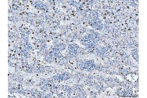 IHC analysis of CD14 using anti-CD14 antibody (ABIN7600531). (CD14 抗体  (AA 20-259))
