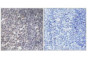 Immunohistochemistry (IHC) image for anti-Mitochondrial Ribosomal Protein S16 (MRPS16) (Internal Region) antibody (ABIN1850528) (MRPS16 抗体  (Internal Region))