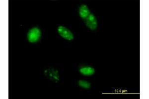 Immunofluorescence of purified MaxPab antibody to TRFP on HeLa cell. (MED20 抗体  (AA 1-212))