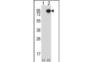 Western blot analysis of CTTN (arrow) using rabbit polyclonal CTTN Antibody (Center) (ABIN657649 and ABIN2846644). (Cortactin 抗体  (AA 273-302))