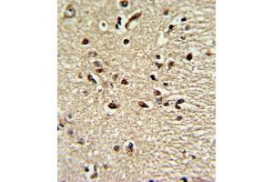 Formalin-fixed and raffin-embedded human brain tissue reacted with X4 Antibody (Center), which was peroxidase-conjugated to the secondary antibody, followed by DAB staining. (PAX4 抗体  (AA 171-200))