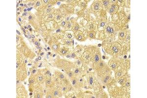Immunohistochemistry of paraffin-embedded Human liver damage using TRAF3IP2 Polyclonal Antibody at dilution of 1:100 (40x lens). (TRAF3IP2 抗体)