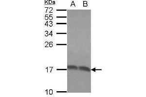 WB Image Sample (30 ug of whole cell lysate) A: Molt-4 B: Raji 15% SDS PAGE antibody diluted at 1:1000 (RPLP2 抗体  (Center))