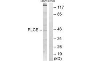 Western blot analysis of extracts from LOVO cells, using AGPAT5 Antibody. (AGPAT5 抗体  (AA 241-290))