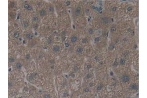 Detection of ALOX12 in Human Liver Tissue using Polyclonal Antibody to Arachidonate-12-Lipoxygenase (ALOX12) (ALOX12 抗体  (AA 352-656))