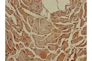 Immunohistochemistry (IHC) image for anti-Solute Carrier Family 16, Member 7 (Monocarboxylic Acid Transporter 2) (SLC16A7) (AA 197-279) antibody (ABIN7160165)