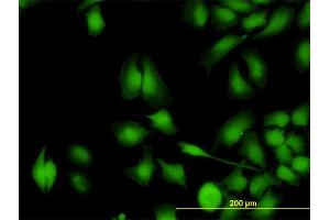 Immunofluorescence (IF) image for anti-Zinc Finger Protein 622 (ZNF622) (AA 1-100) antibody (ABIN566640)
