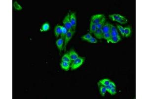 Immunofluorescent analysis of PC-3 cells using ABIN7153961 at dilution of 1:100 and Alexa Fluor 488-congugated AffiniPure Goat Anti-Rabbit IgG(H+L) (Glutamate Receptor 3 抗体  (AA 151-250))