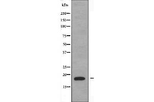 Western blot analysis of extracts from K562 cells, using PBOV1 antibody. (PBOV1 抗体  (Internal Region))