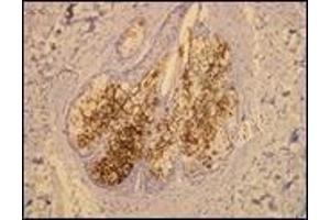 Immunohistochemistry (IHC) image for anti-Mucin 1 (MUC1) (C-Term) antibody (ABIN870418) (MUC1 抗体  (C-Term))