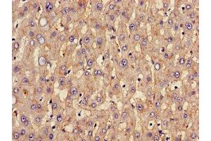 Immunohistochemistry (IHC) image for anti-Solute Carrier Family 2 (Facilitated Glucose Transporter), Member 1 (SLC2A1) (AA 263-458) antibody (ABIN7170002)