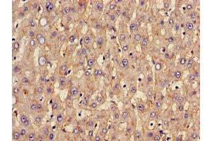 Immunohistochemistry of paraffin-embedded human liver tissue using ABIN7170002 at dilution of 1:100 (GLUT1 抗体  (AA 263-458))