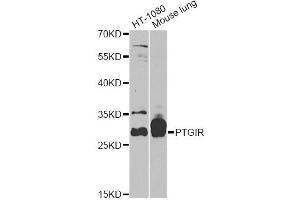 Western blot analysis of extracts of various cell lines, using PTGIR antibody (ABIN5970948) at 1/1000 dilution. (Prostacyclin Receptor 抗体)