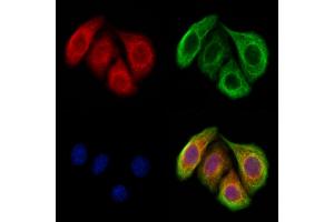 ABIN7094435 and ABIN7098483 staining Hela cells by IF/ICC.