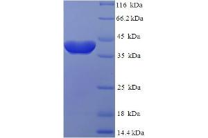 SDS-PAGE (SDS) image for RAB2A, Member RAS Oncogene Family (RAB2A) (AA 2-212) protein (His-SUMO Tag) (ABIN5710205)