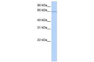 Western Blotting (WB) image for anti-Pumilio RNA Binding Family Member 3 (PUM3) antibody (ABIN2458487) (KIAA0020 抗体)