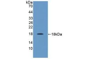 Detection of Recombinant IL17, Rat using Polyclonal Antibody to Interleukin 17 (IL17) (IL-17 抗体  (AA 18-150))