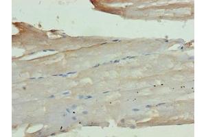 Immunohistochemistry of paraffin-embedded human skeletal muscle tissue using ABIN7163920 at dilution of 1:100 (KCNK13 抗体  (AA 292-408))