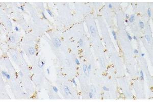 Immunohistochemistry (Paraffin-embedded Sections) (IHC (p)) image for anti-Gap Junction Protein, alpha 1, 43kDa (GJA1) (pSer368) antibody (ABIN7265286)