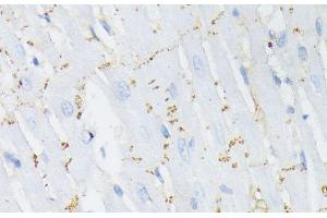 Immunohistochemistry of paraffin-embedded Rat heart using Phospho-GJA1(S368) Polyclonal Antibody at dilution of 1:200 (40x lens). (Connexin 43/GJA1 抗体  (pSer368))