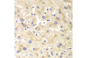 Immunohistochemistry of paraffin-embedded human liver injury using DNM1L antibody. (Dynamin 1-Like 抗体)