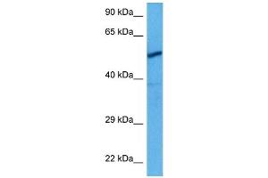 Host:  Rat  Target Name:  CHRNA3  Sample Tissue:  Rat Skeletal Muscle  Antibody Dilution:  1ug/ml (CHRNA3 抗体  (N-Term))