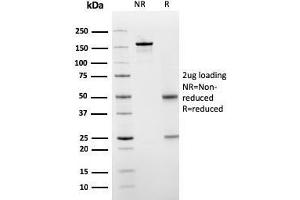 SDS-PAGE Analysis Purified PAI-RBP1 Mouse Monoclonal Antibody (SERBP1/3498).