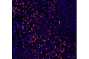 Immunofluorescence (IF) image for anti-General Transcription Factor III (GTF2I) (C-Term) antibody (ABIN7448970)