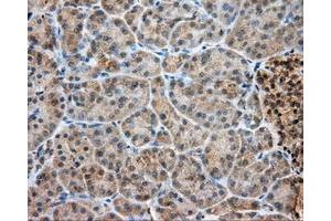 Immunohistochemical staining of paraffin-embedded Kidney tissue using anti-LIPG mouse monoclonal antibody. (LIPG 抗体)