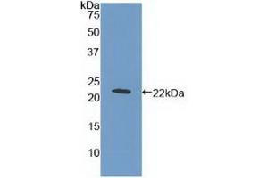 Detection of Recombinant MPL, Human using Polyclonal Antibody to Thrombopoietin Receptor (TPOR) (MPL 抗体  (AA 311-460))