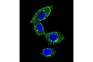 Confocal immunofluorescent analysis of SORBS1 / Ponsinin Antibody  with MDA-MB231 cell followed by Alexa Fluor 488-conjugated goat anti-rabbit lgG (green). (SORBS1 抗体  (Middle Region))