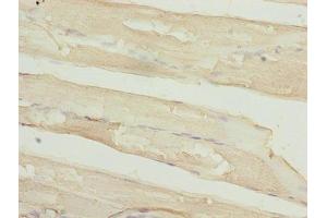 Immunohistochemistry of paraffin-embedded human skeletal muscle tissue using ABIN7159481 at dilution of 1:100 (TIMP1 抗体  (AA 24-207))