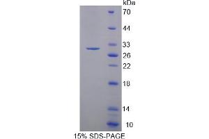 Image no. 1 for Myosin Light Chain Kinase 3 (MYLK3) (AA 555-786) protein (His tag) (ABIN6238094) (MYLK3 Protein (AA 555-786) (His tag))