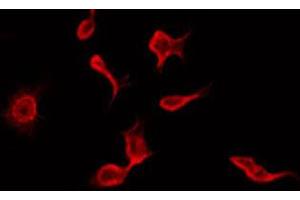 ABIN6272297 staining HepG2 by IF/ICC. (RIMKLB 抗体  (Internal Region))
