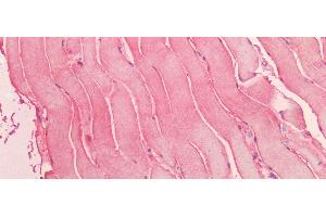 Immunohistochemistry (IHC) image for anti-Myoglobin (MB) (AA 1-154) antibody (ABIN7429604)