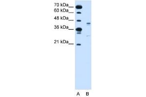GPR161 antibody used at 2 ug/ml to detect target protein. (GPR161 抗体  (Middle Region))
