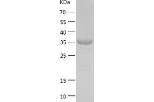 Western Blotting (WB) image for ISL LIM Homeobox 1 (ISL1) (AA 2-349) protein (His tag) (ABIN7123637) (ISL1 Protein (AA 2-349) (His tag))