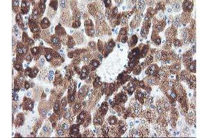 Immunohistochemical staining of paraffin-embedded Human liver tissue using anti-CYP1A2 mouse monoclonal antibody. (CYP1A2 抗体)