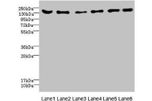 Western blot All lanes: CD1C antibody at 4. (ADGRG6 (AA 40-300) 抗体)