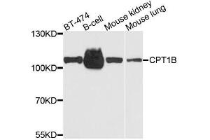 Western blot analysis of extracts of various cell lines, using CPT1B antibody. (CPT1B 抗体  (AA 533-772))